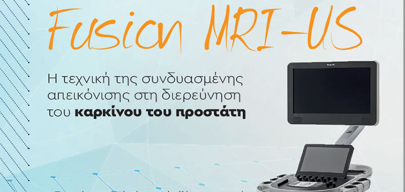 Διερεύνηση καρκίνου προστάτη