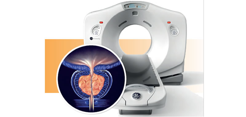 PET/CT στην απεικόνιση του καρκίνου του προστάτη