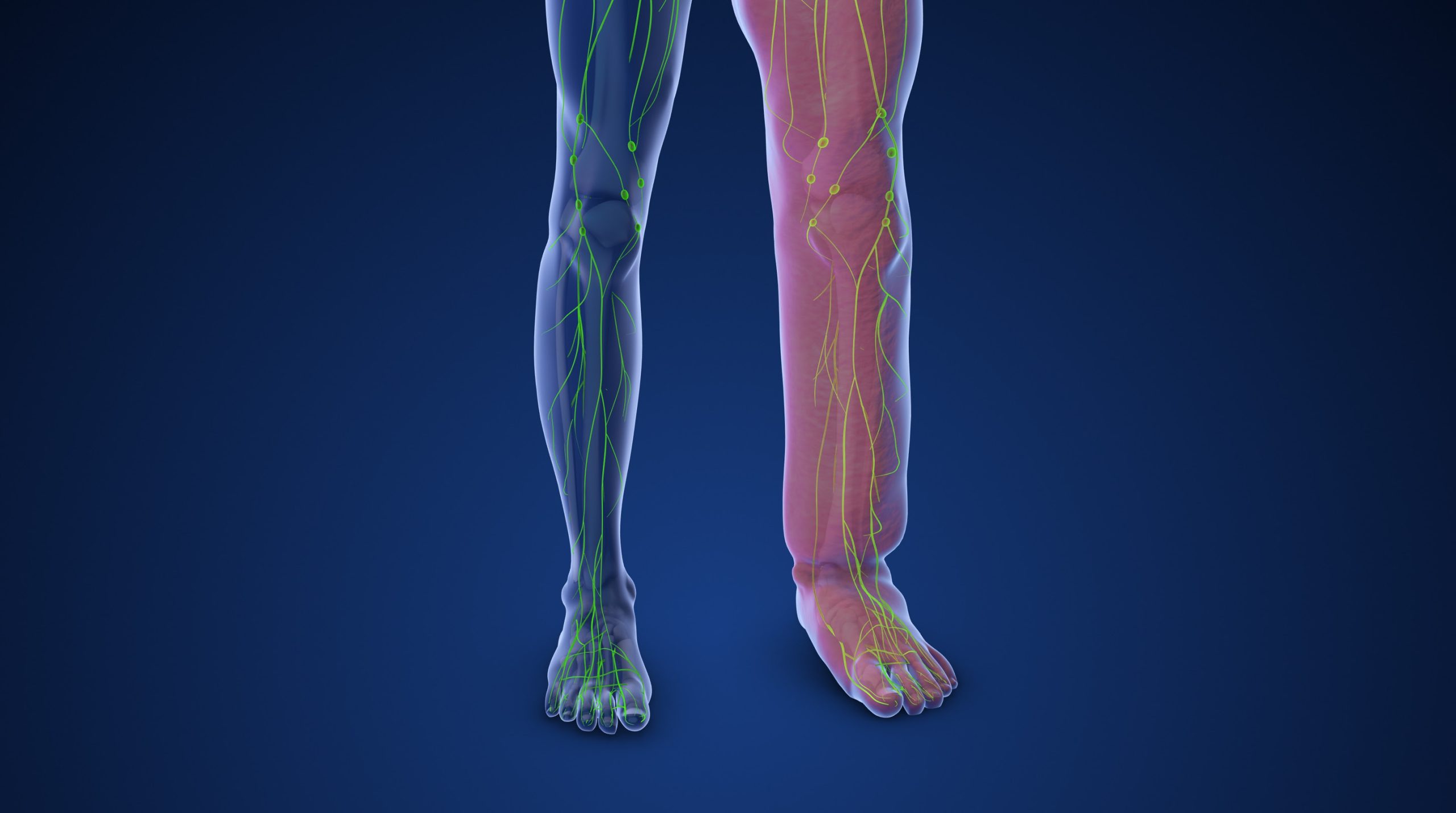 bioiatriki_lemfidima_βιοιατρική_λεμφοίδημα