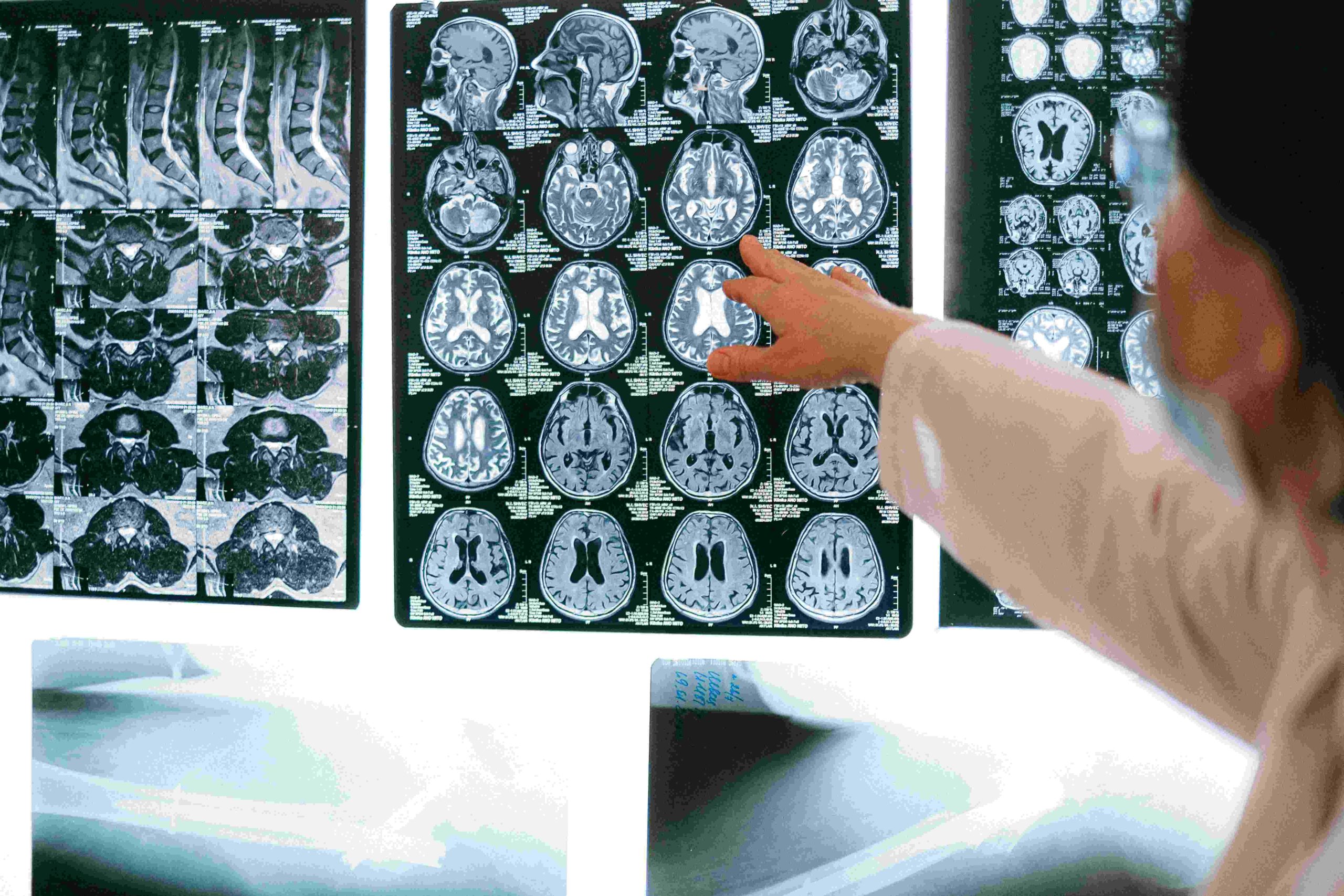 Ολόσωμη Μαγνητική Τομογραφία (WB MRI)_ΒΙΟΙΑΤΡΙΚΙ_BIOIATRIKH_